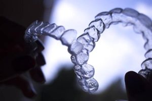 Invisalign in Brisbane